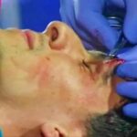 إشبيلية يكشف عن وضعية بونو بعد الإصابة